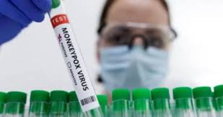 थाइल्याण्डमा एसियामै सबैभन्दा पहिलो पटक मंकिपक्स रोग देखियो